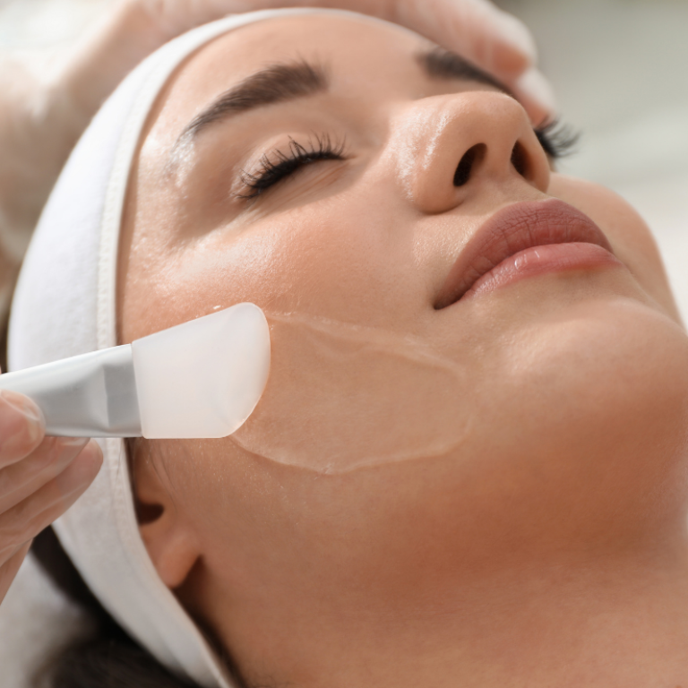 Skinnova - chemical peel
